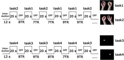 Brain Function and Upper Limb Deficit in Stroke With Motor Execution and Imagery: A Cross-Sectional Functional Magnetic Resonance Imaging Study